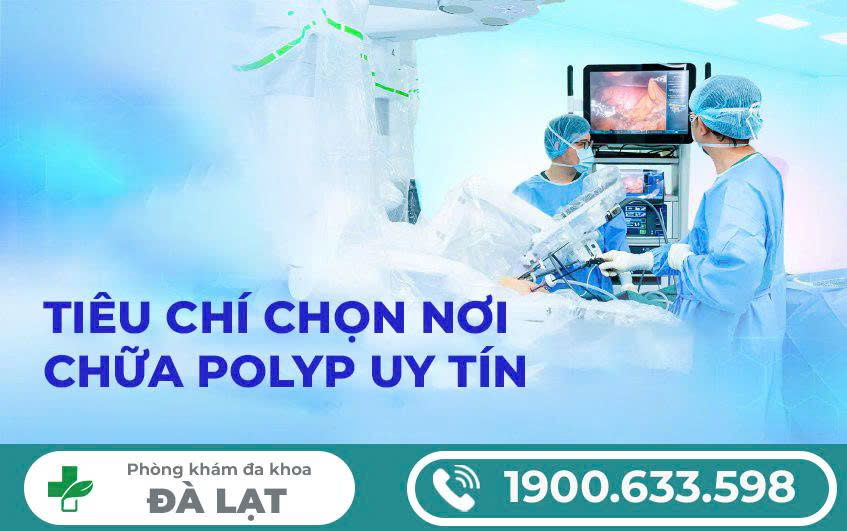 Hình ảnh minh họa